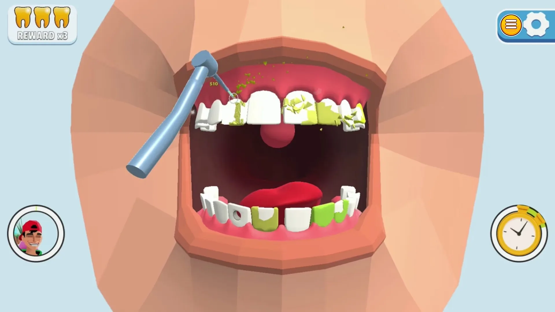 Dentist Bling: Complete Edition [One,&nbsp;X|S] - изображение 3