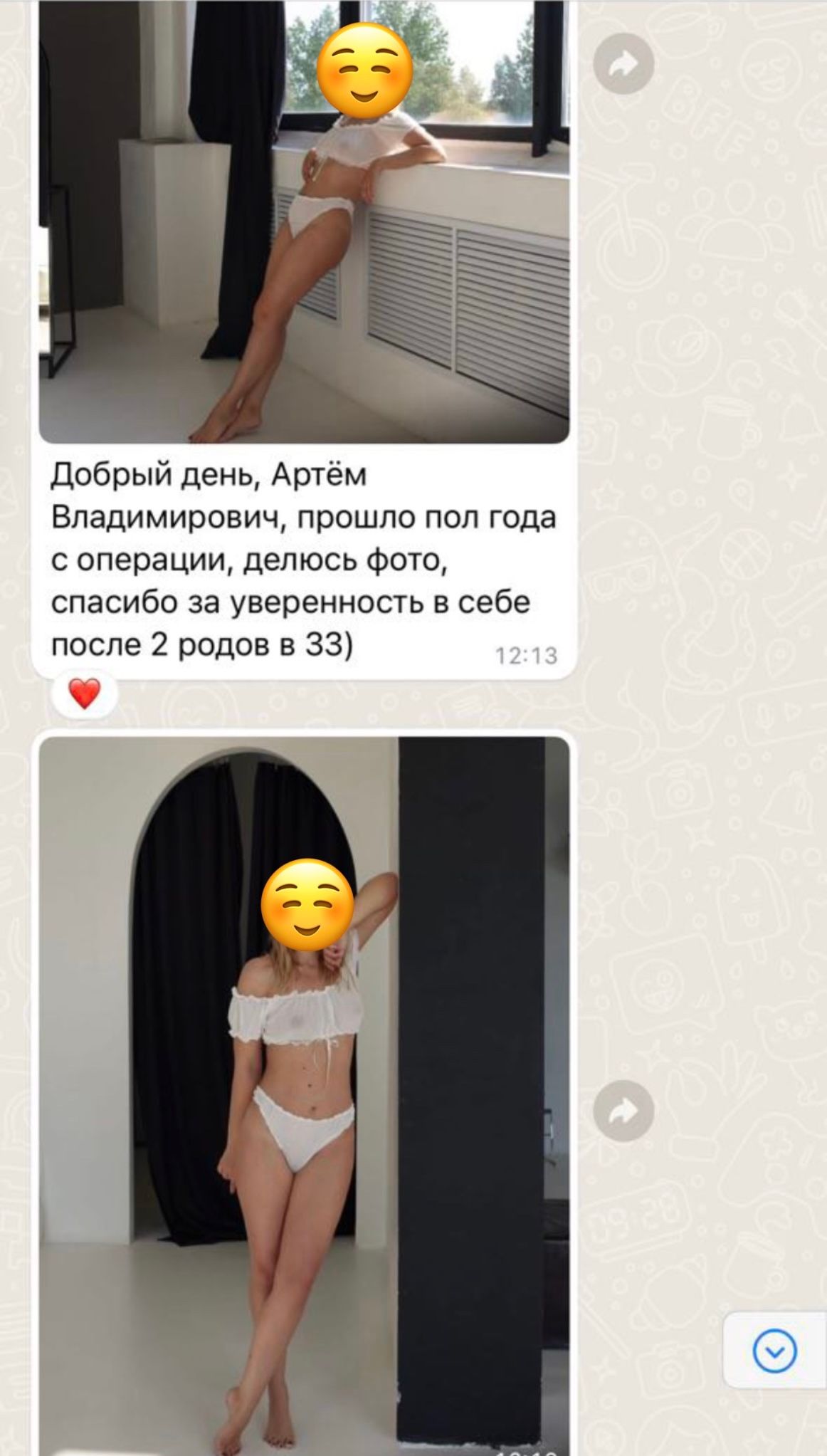 Добрый день, Артём Владимирович, прошло пол года с операции, делюсь фото, спасибо за уверенность в себе после 2 родов в 33)