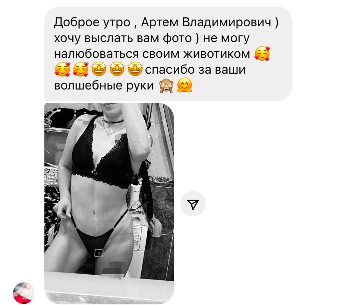 Доброе утро, Артем Владимирович ) хочу выслать вам фото ) не могу налюбоваться своим животиком 🥰🥰🥰🤩🤩🤩 спасибо за ваши волшебные руки 🙈🤗