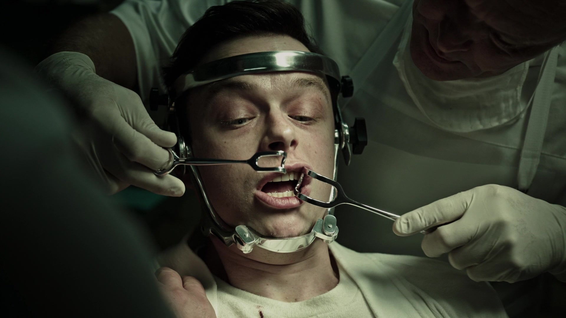 A Cure for Wellness (2017), unknown, 1.78:1 — film still