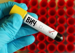 Предоставление мер социальной поддержки семьям, воспитывающим ВИЧ-инфицированных-несовершеннолетних до 18 лет по оплате жилого помещения и коммунальных услуг.