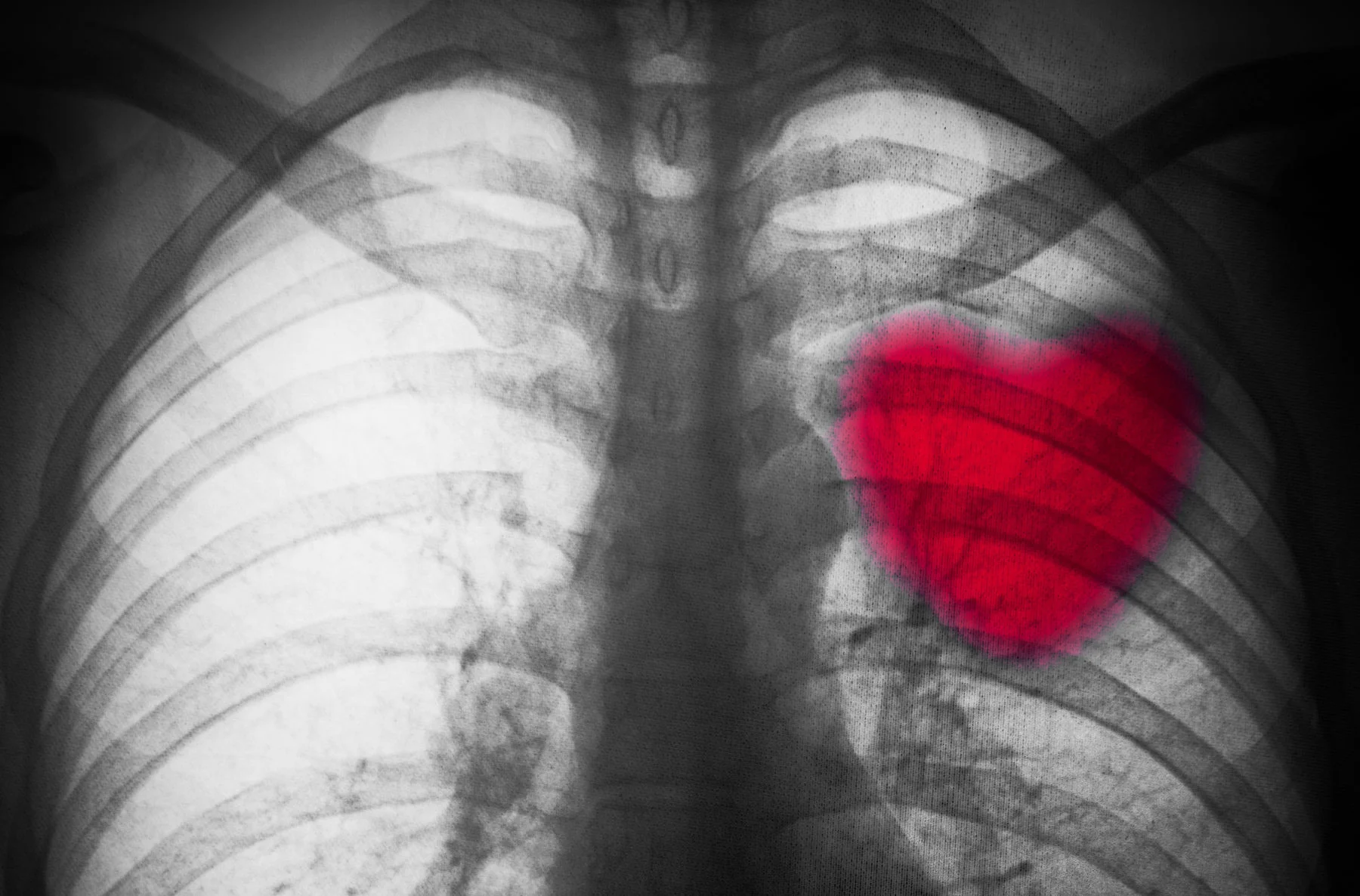 Мы задыхаемся от равнодушия