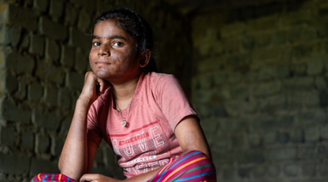 Сокращение иностранной помощи ставит Детей Поколения Альфа под угрозу лепры, предупреждает христианская благотворительность