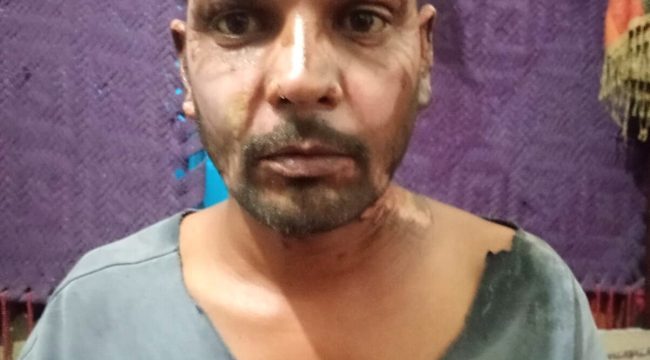 Мусульманин в Пакистане поджог христианина из-за пустякового спора