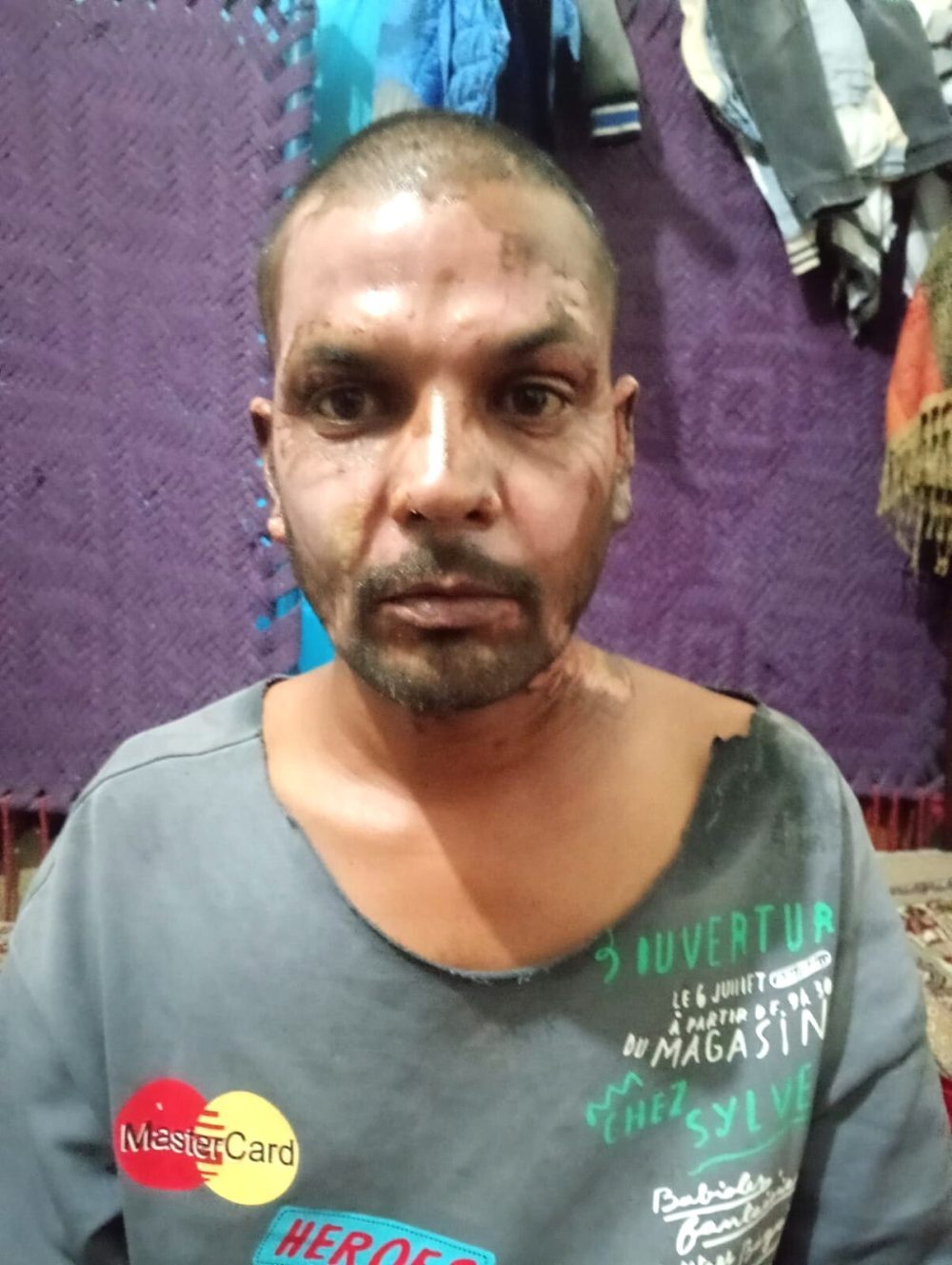 Мусульманин в Пакистане поджог христианина из-за пустякового спора