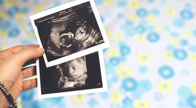 Пуэрто-Рико предоставляет юридическую защиту нерожденным детям; сторонники защиты жизни называют это 'историческим моментом'