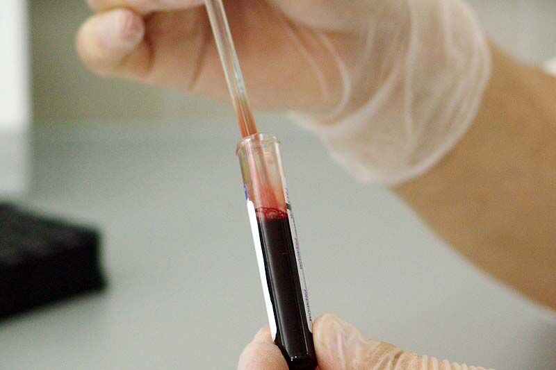 В этом году у 454 зауральцев выявили вирус иммунодефицита