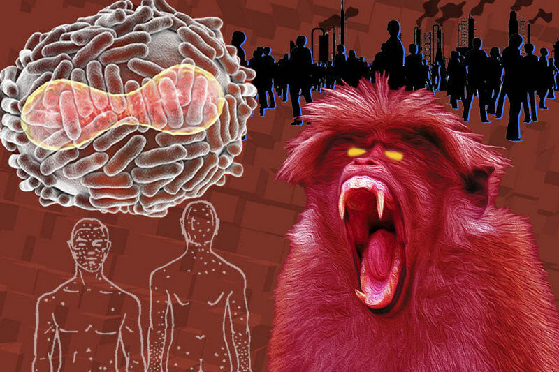 Почему не стоит бояться обезьяньей оспы