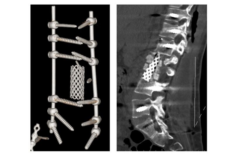 Курганские нейрохирурги спасли жизнь пациентке, выпавшей из высотной многоэтажки