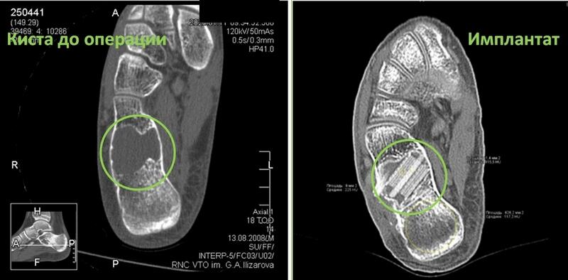 новости курган
