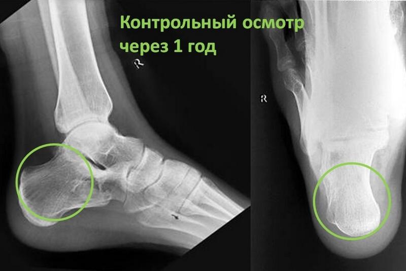 новости курган