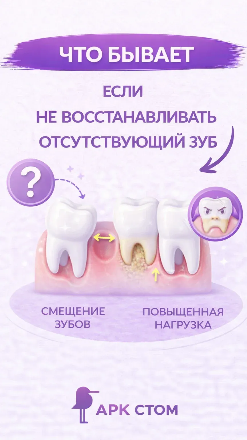 Что будет, если не восстанавливать отсутствующий зуб?