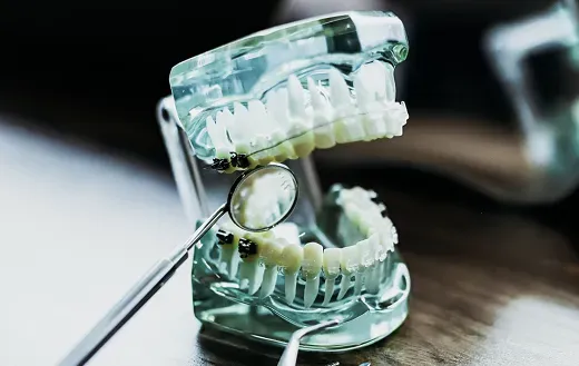 Брекеты 0 рублей