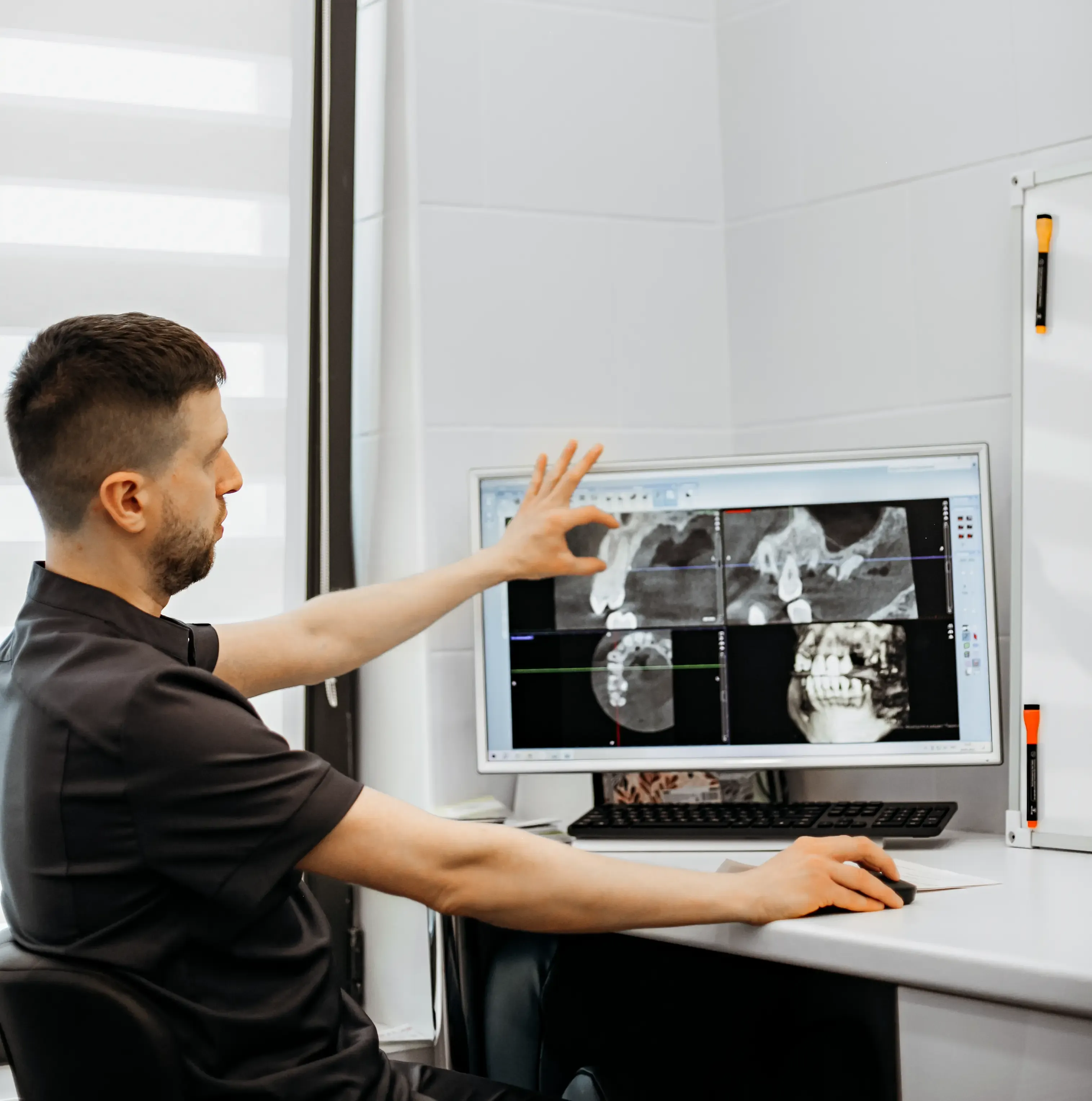 Имплантация