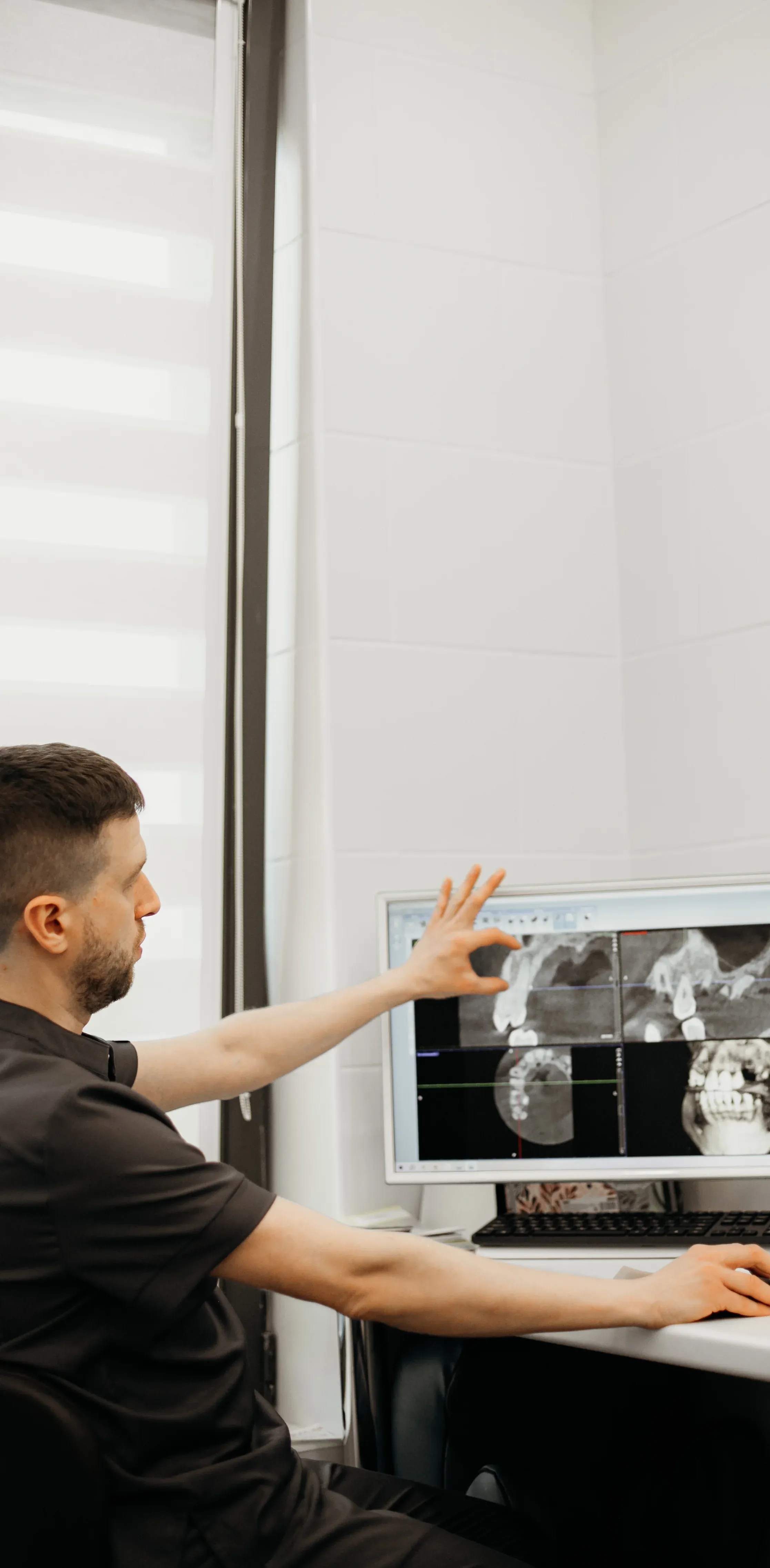 Имплантация