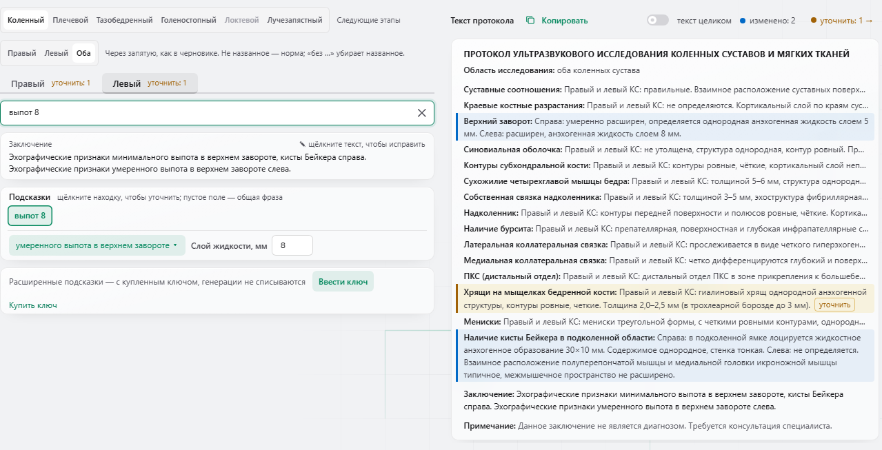 Режим «Оба»: вкладки «Правый» и «Левый» со счётчиками «уточнить», строка ввода и текст протокола справа