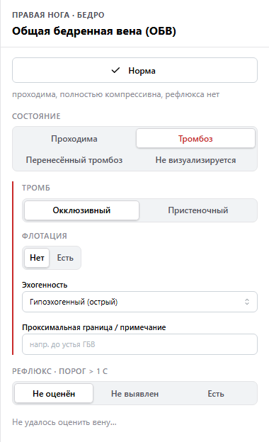 Панель общей бедренной вены в редакторе Sumuhar с состоянием «Тромбоз»: тип тромба, флотация, эхогенность, проксимальная граница, рефлюкс