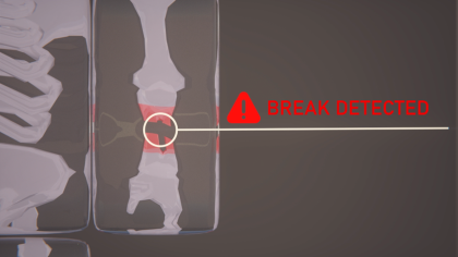 Xray footage