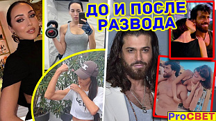 Алсу до/после развода. ProСВЕТ